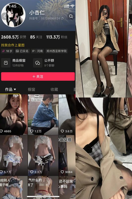 抖音 小杏仁 微密圈  NO.007 【61P】最新至：2025.3.10-岛屿电鸽微密圈-全网最全抖音网红高质量总站